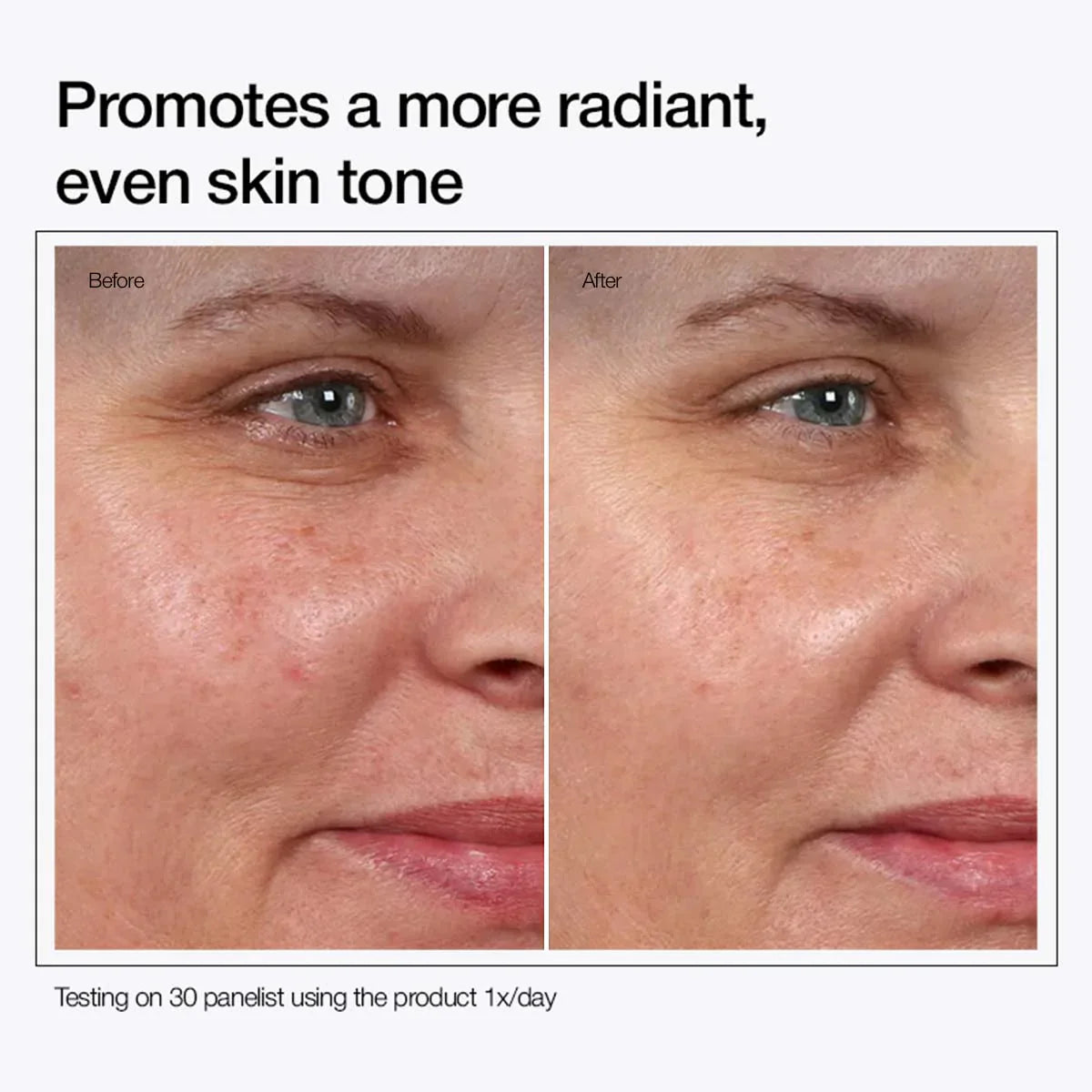 Urapra™ Glycolic Acid 7% Toner Solution